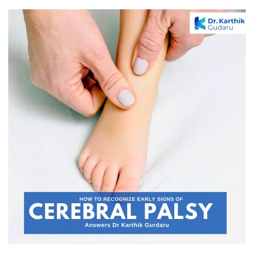cerebral palsy treatment in Hyderabad, Telangana Dr Karthik Gudaru