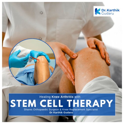Best Knee Arthritis treatment Hyderabad stem cell therapy by Dr Karthik Gudaru