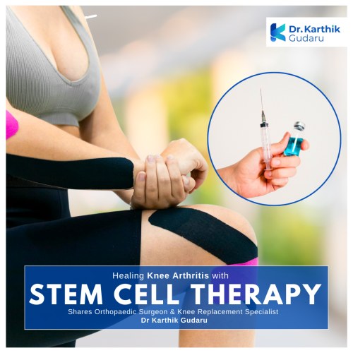 Best Knee Arthritis treatment Hyderabad stem cell therapy by Dr Karthik Gudaru