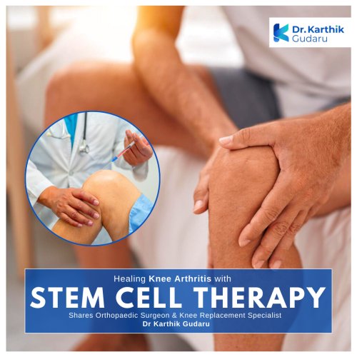 Knee Arthritis treatment stem cell therapy hyderabad Dr Karthik Gudaru