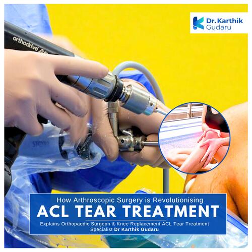 best surgeon for ACL tear surgery in Hyderabad_Dr Karthik Gudaru