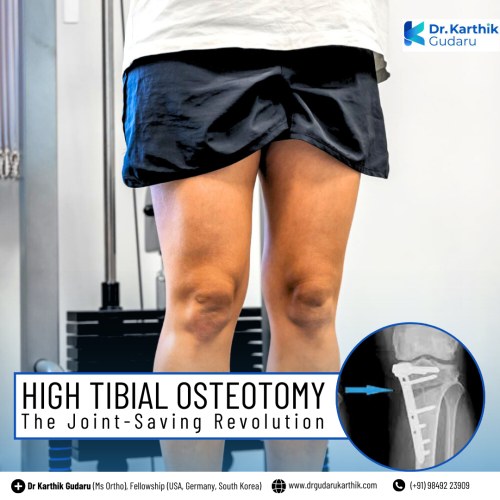 Dr Karthik Gudaru Total Knee Replacement orthopedic surgeon in Hyderabad Telangana