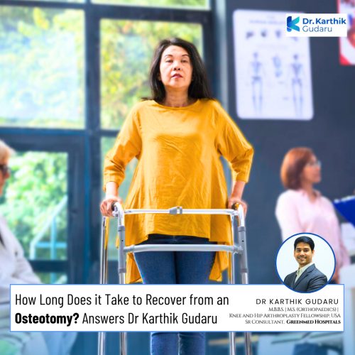 How Long Does It Take to Recover from an Osteotomy? 