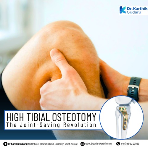 Best Knee Replacement orthopedic surgeon in Hyderabad Telangana