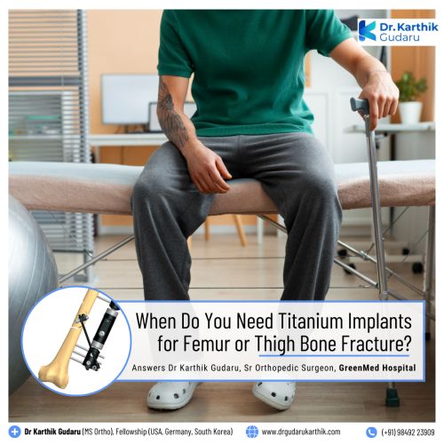 Dr Karthik Gudaru orthopedic surgeon for Titanium Implants for Thigh Bone Fracture