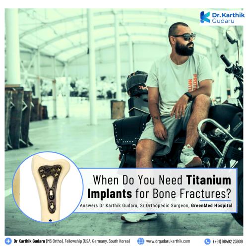 Dr Karthik Gudaru best orthopaedic surgeon for titanium Implants for Femur in Hyderabad Telangana