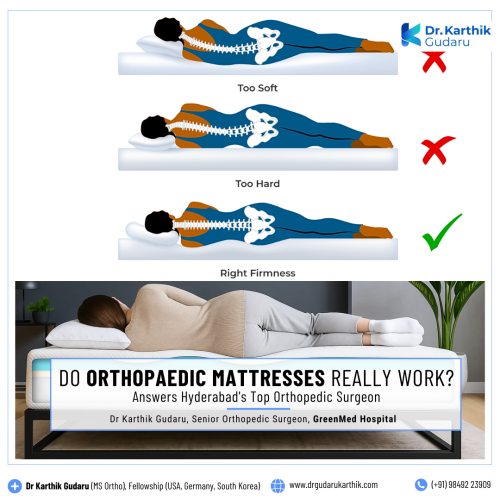 Dr Karthik Gudaru orthopedic doctor how to buy Orthopedic Mattress