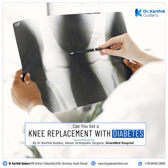 Knee Replacement with Diabetes in Hyderabad Orthopedic Surgeon Dr Karthik Gudaru