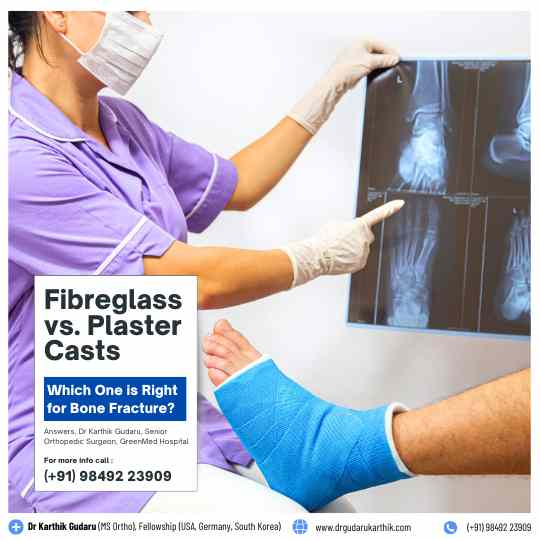 Fiberglass or Plaster Cast for bone Fracture  Orthopedic insight