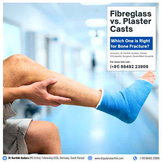 Fiberglass or Plaster Cast for bone Fracture  Orthopedic insight