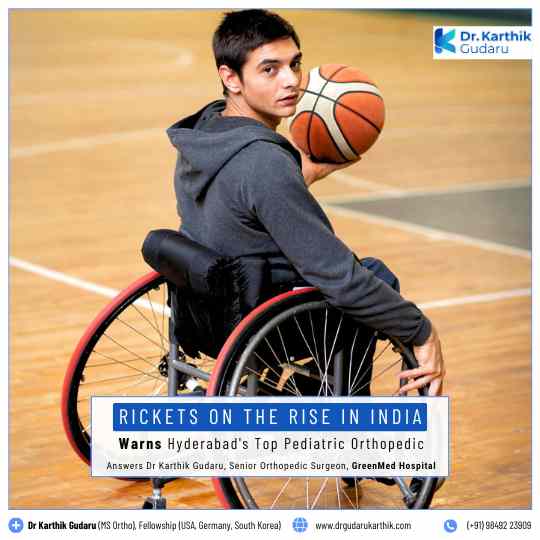 Rickets treatment in Hyderabad by Pediatric Orthopedic Dr Karthik Gudaru