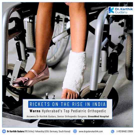 Rickets treatment in Hyderabad by Pediatric Orthopedic Dr Karthik Gudaru