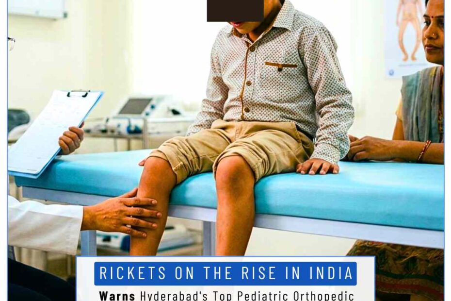 Rickets treatment in Hyderabad by Pediatric Orthopedic Dr Karthik Gudaru