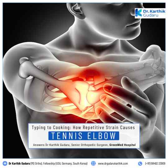 Specialist Orthopaedic Surgeon for Tennis Elbow Treatment in Hyderabad - Dr Karthik Gudaru