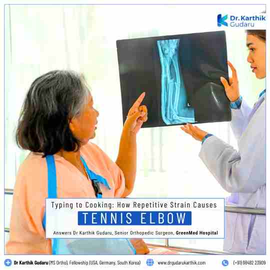Specialist Orthopaedic Surgeon for Tennis Elbow Treatment in Hyderabad