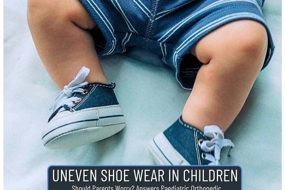 Specialist Paediatric Orthopaedic Doctors in Hyderabad Dr karthik gudaru