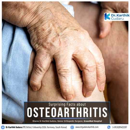 Surprising Facts About Osteoarthritis by Dr Karthik Gudaru Hyderabad